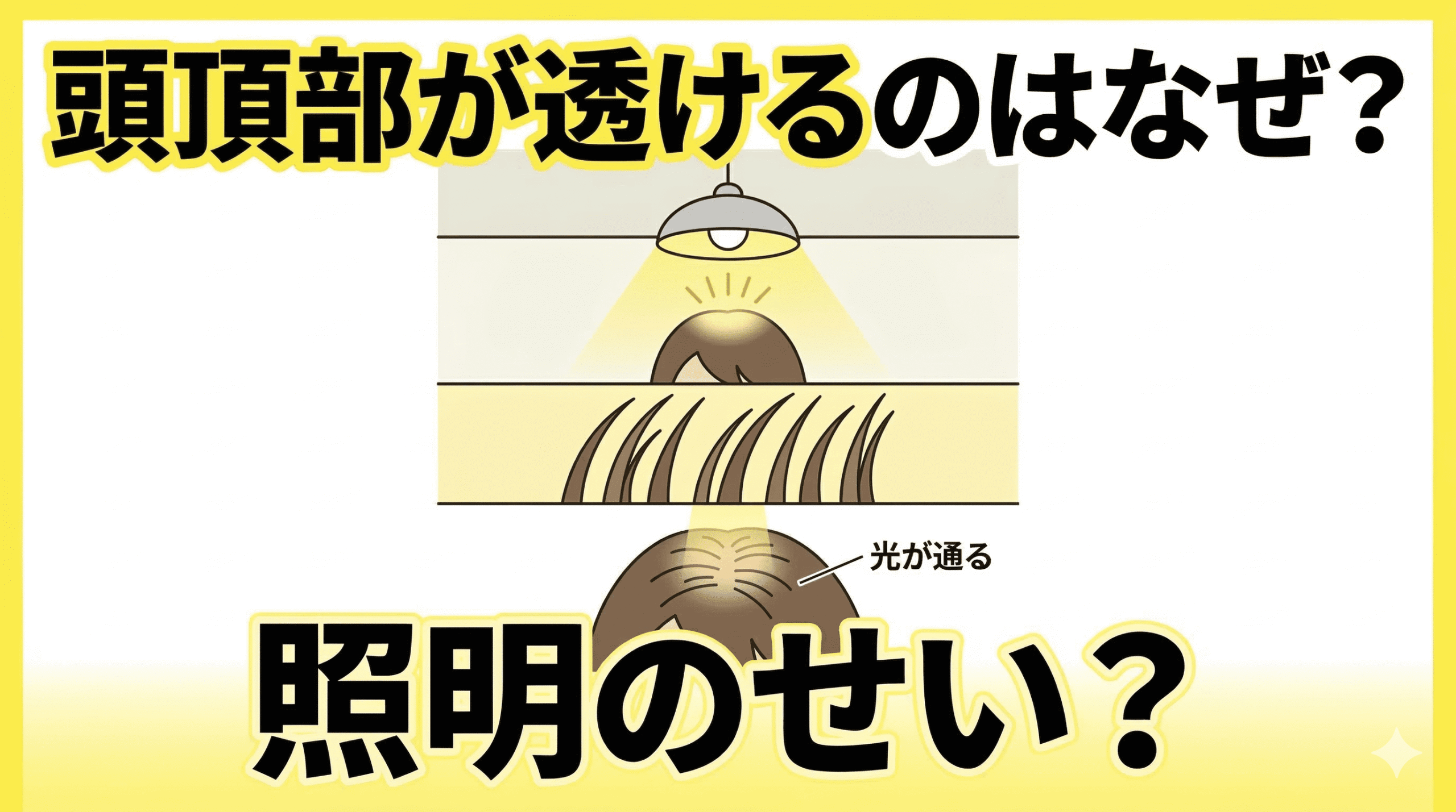 オフィスの蛍光灯下で頭頂部が透けて見える様子
