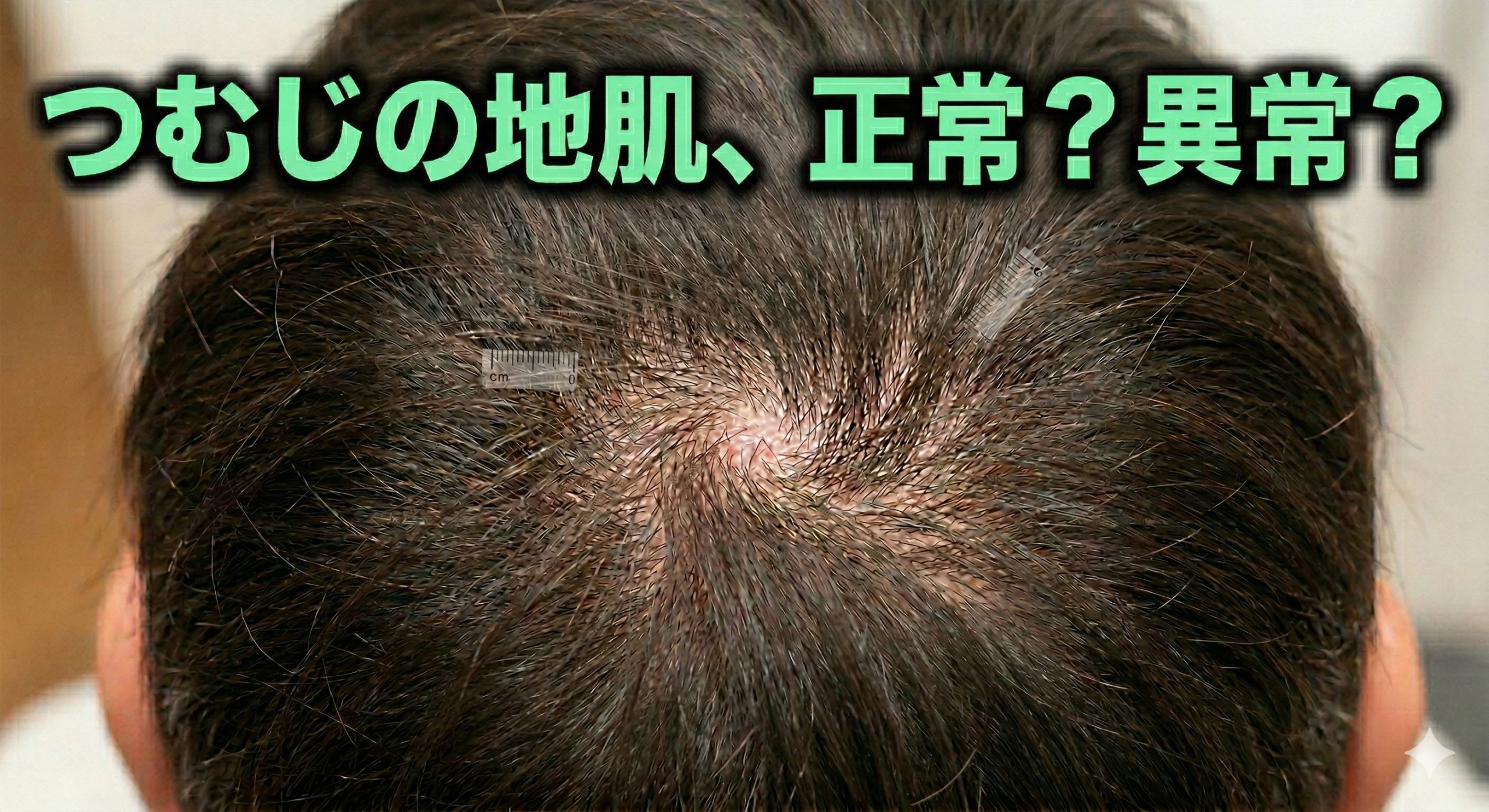 つむじの地肌が見えるのは正常？異常との見分け方を解説